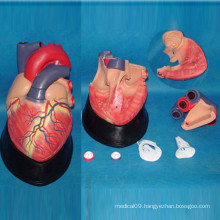 Human Heart Medical Anatomy Demonstration Model (7 pieces)